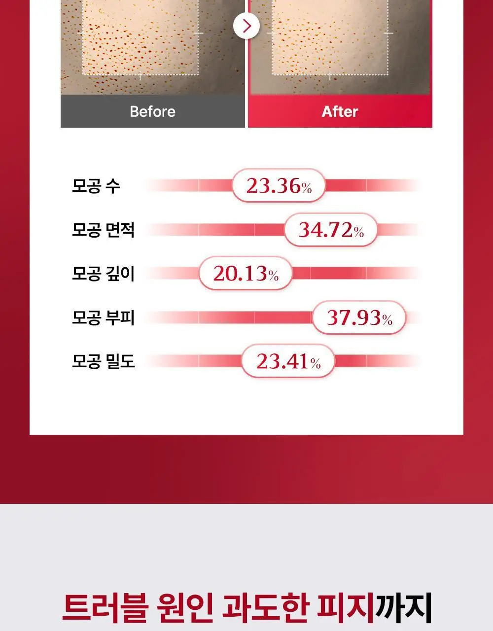 [리뉴얼/원조패드]코스알엑스 원스텝 패드 100매 4종 중 택1 상세페이지 18